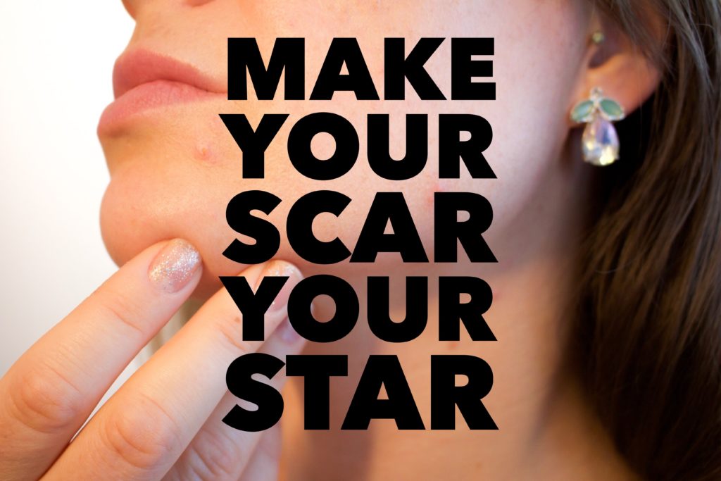 Make Your Scar Your Star